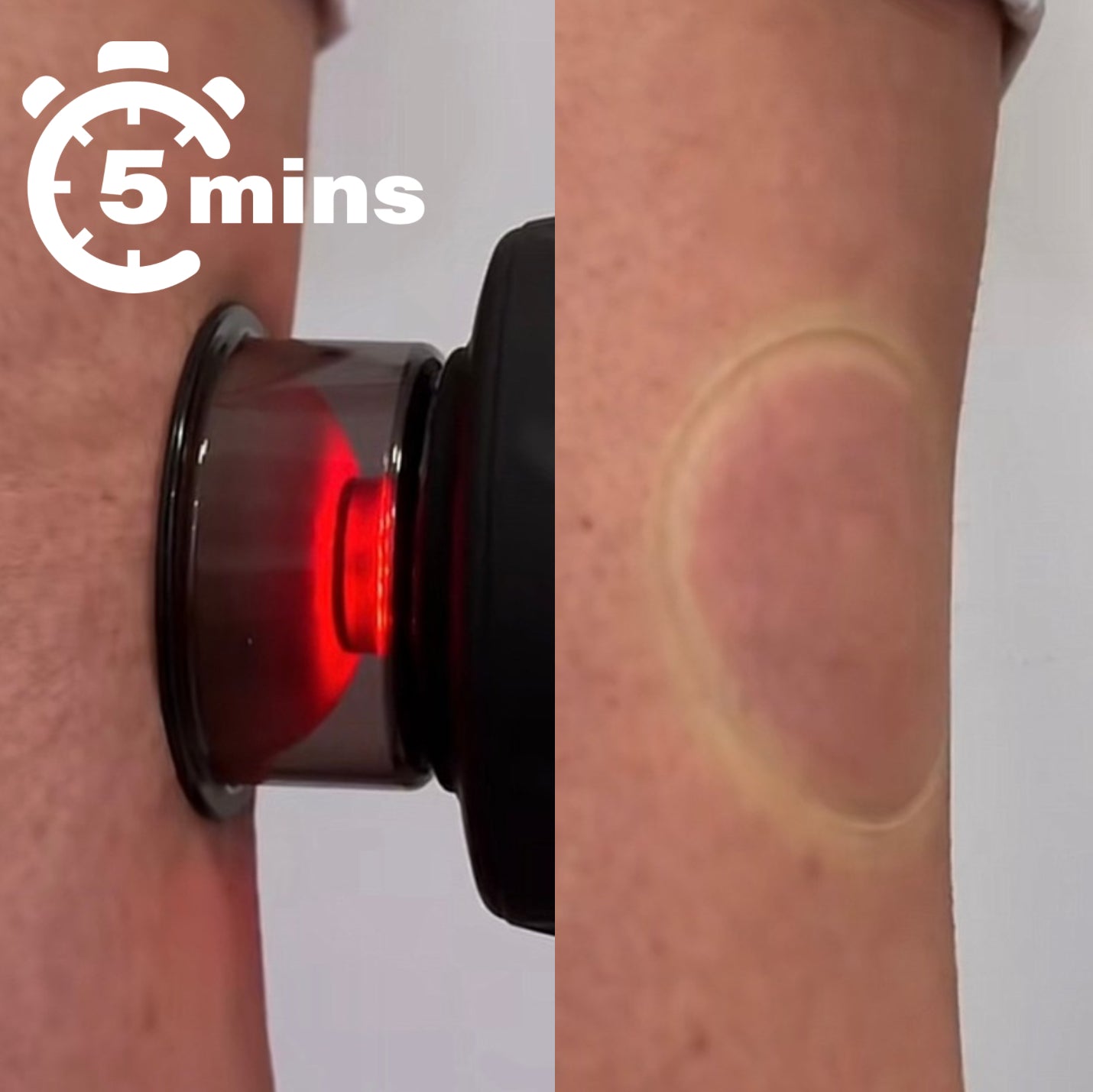 CupaBem – Alívio Instantâneo e Portátil Onde Você Estiver